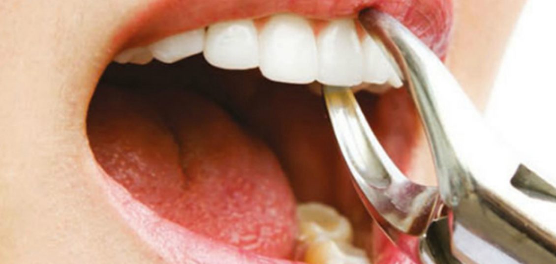 Dental Diş Nedir