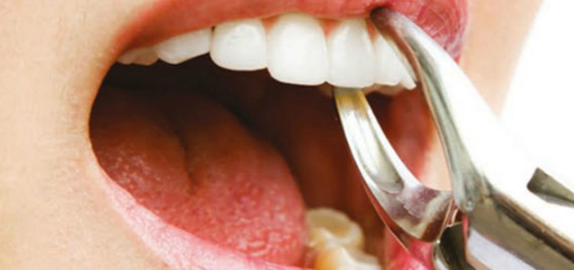 Dental Diş Nedir