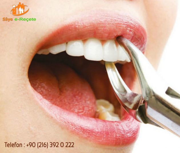 Dental Diş Nedir